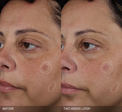 Faded Complete Dark Spot Bundle